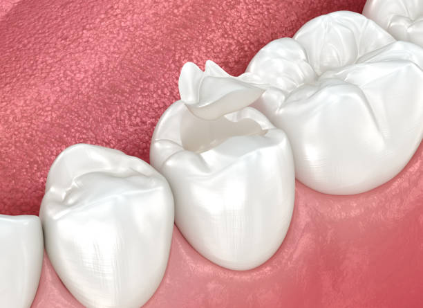 Our Range of Dental Services in Latimer, MS